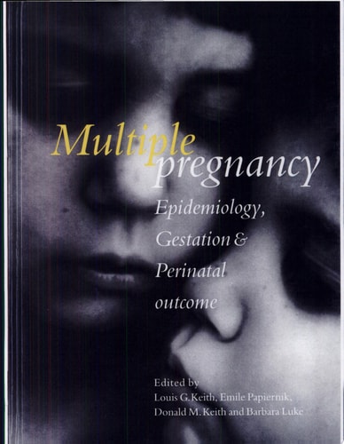 Multiple Pregnancy: Epidemiology, Gestation & Perinatal Outcome