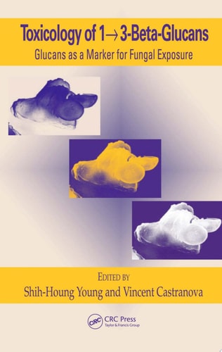Toxicology of 1,3-Beta-Glucans: Glucans as a Marker for Fungal Exposure