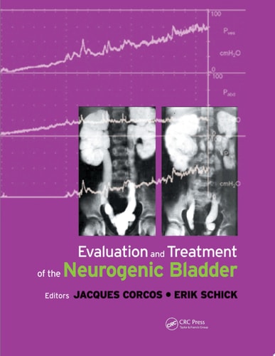 Essential Guide to the Neurogenic Bladder