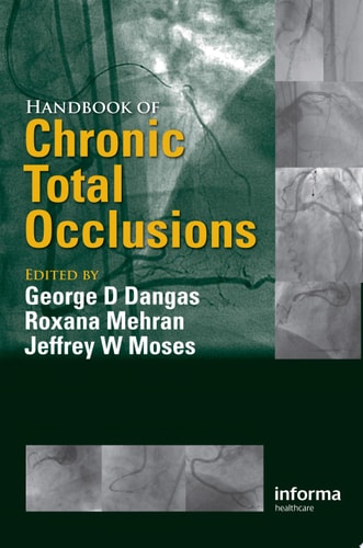 Handbook of Chronic Total Occlusions