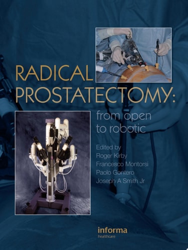 Radical Prostatectomy: From Open to Robotic