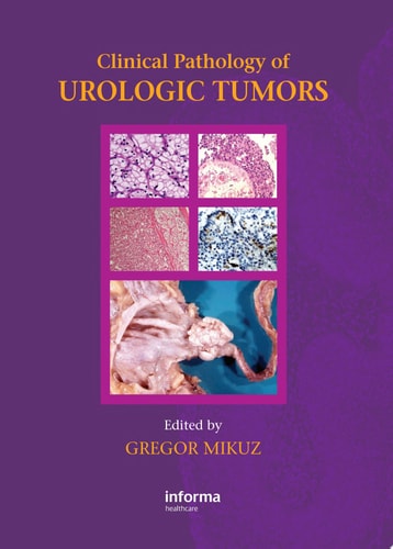 Clinical Pathology of Urological Tumours