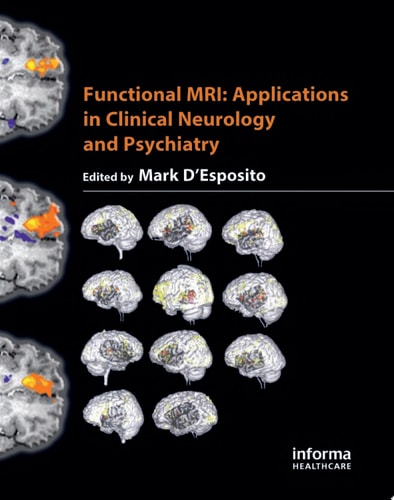 Functional MRI: Applications in Clinical Neurology and Psychiatry
