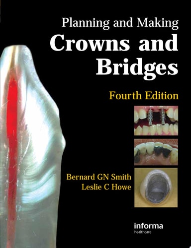 Planning and Making Crowns and Bridges