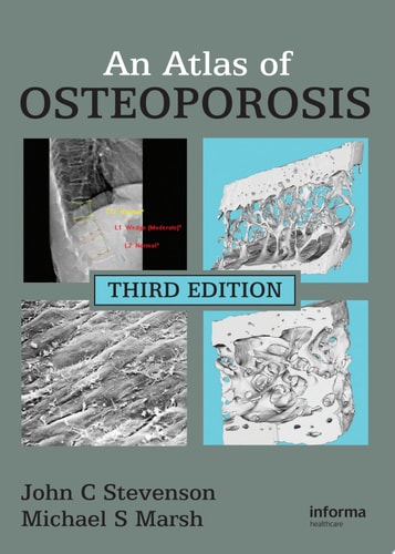 An Atlas of Osteoporosis