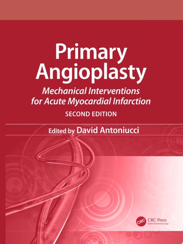 Primary Angioplasty: Mechanical Interventions for Acute Myocardial Infarction