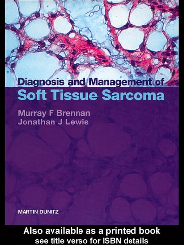 Diagnosis and Management of Soft Tissue Sarcoma