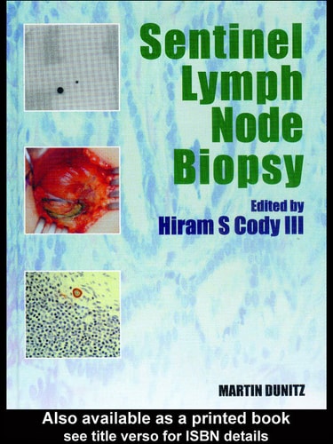Sentinel Lymph Node Biopsy