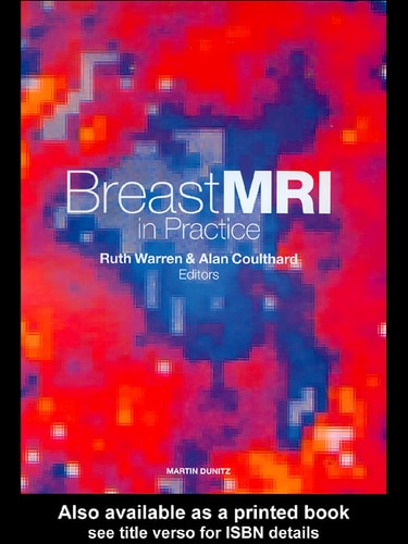 Breast MRI in Practice