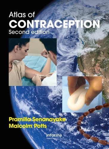 Atlas of Contraception