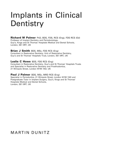 Implants in Clinical Dentistry