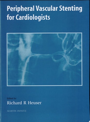Peripheral Vascular Stenting