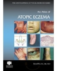Atlas of Atopic Eczema