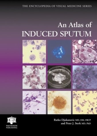 Atlas of Induced Sputum