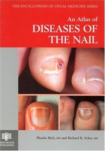 Atlas of Diseases of the Nail