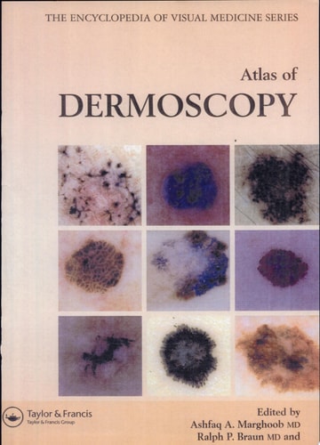 Atlas of Dermoscopy