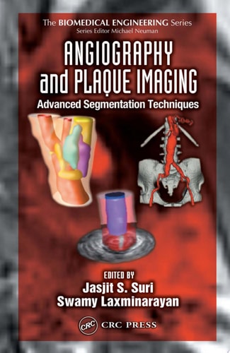Angiography and Plaque Imaging: Advanced Segmentation Techniques