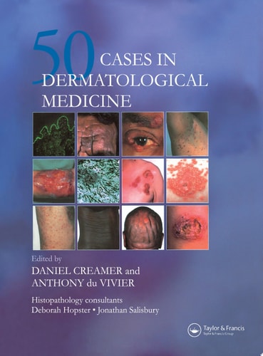 50 Cases in Dermatological Medicine