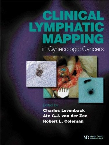 Clinical Lymphatic Mapping in Gynecologic Cancers