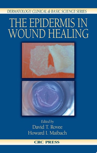 The Epidermis in Wound Healing