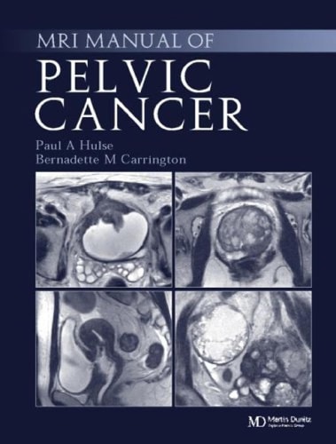 MRI Manual of Pelvic Cancer