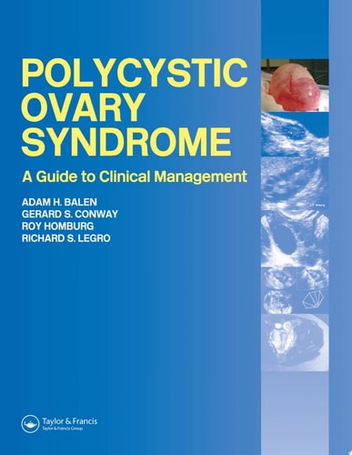 Polycystic Ovary Syndrome: A Guide to Clinical Management