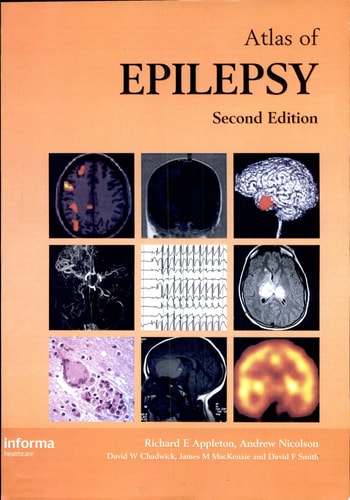 Atlas of Epilepsy