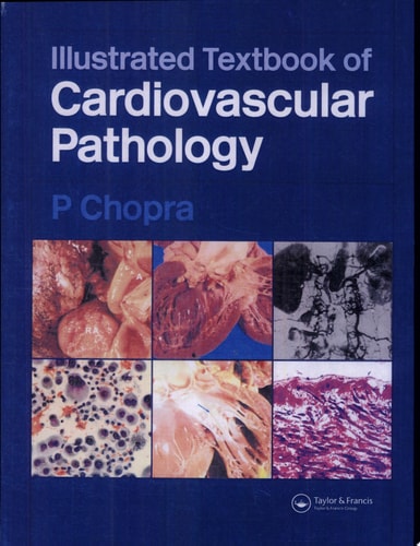 Illustrated Textbook of Cardiovascular Pathology