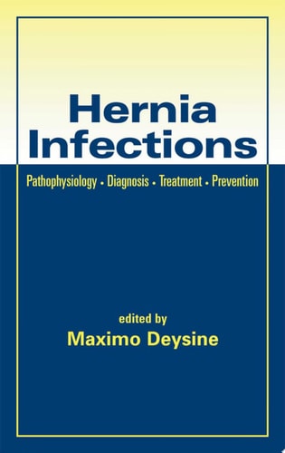 Hernia Infections
