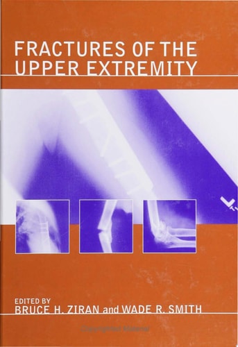 Fractures of the Upper Extremity