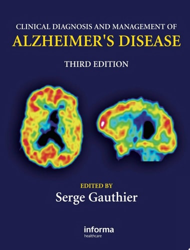 Clinical Diagnosis and Management of Alzheimer's Disease
