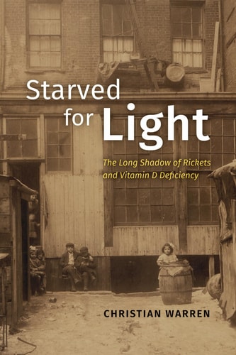 Starved for Light The Long Shadow of Rickets and Vitamin D Deficiency