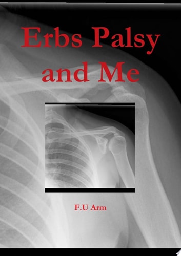 Erbs Palsy and Me