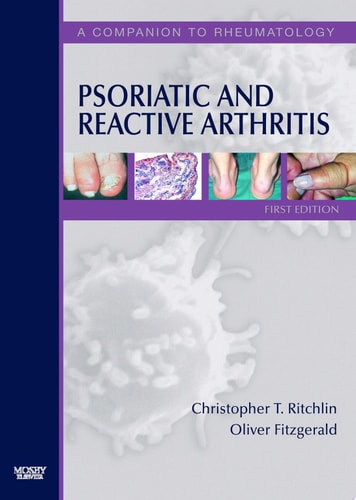 Psoriatic and Reactive Arthritis E-Book A Companion to Rheumatology