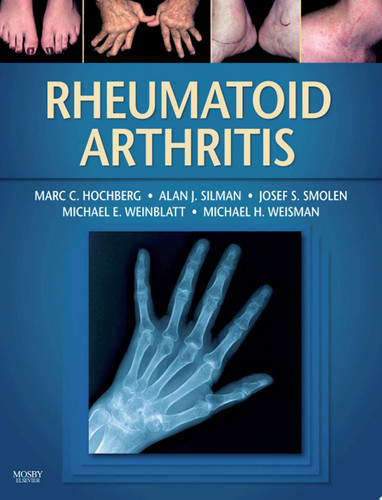 Rheumatoid Arthritis E-Book