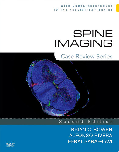 Spine Imaging: Case Review Series
