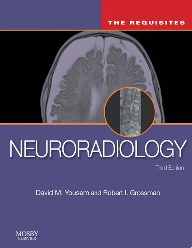 Neuroradiology: The Requisites E-Book