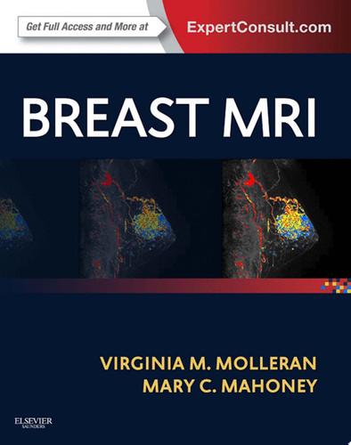 Breast MRI E-Book