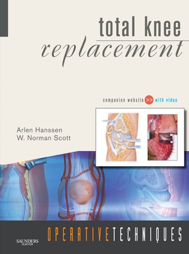 Operative Techniques: Total Knee Replacement - Electronic
