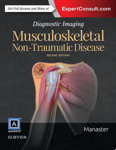 Diagnostic Imaging: Musculoskeletal Non-Traumatic Disease E-Book Diagnostic Imaging: Musculoskeletal Non-Traumatic Disease E-Book
