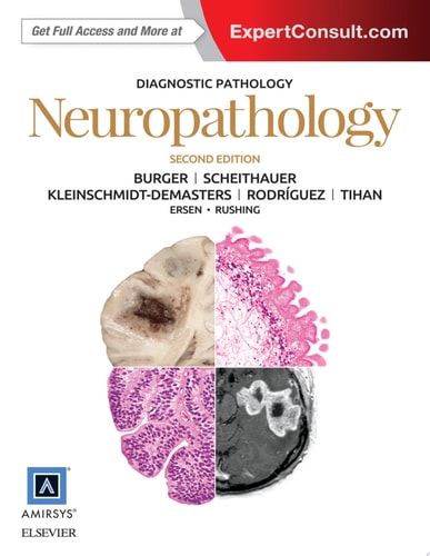 Diagnostic Pathology: Neuropathology E-Book Diagnostic Pathology: Neuropathology E-Book