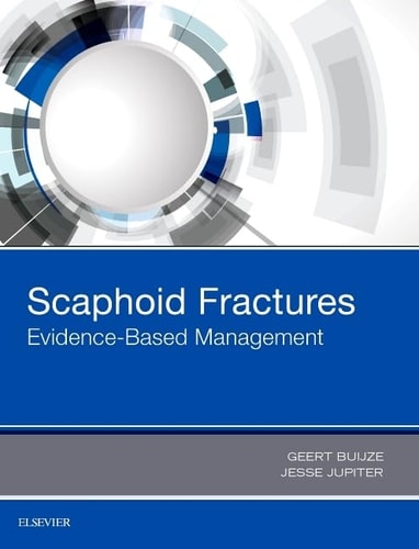 Scaphoid Fractures Evidence-Based Management