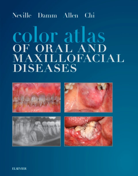 Color Atlas of Oral and Maxillofacial Diseases Elsevier eBook on VitalSource