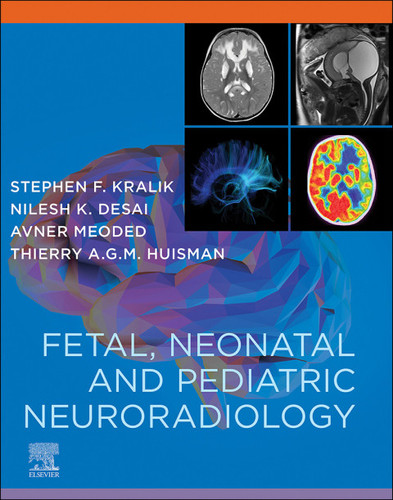 Fetal and Pediatric Neuroradiology Companion