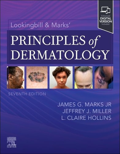 Lookingbill and Marks' Principles of Dermatology