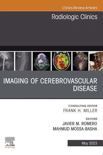Imaging of Cerebrovascular Disease, An Issue of Radiologic Clinics of North America, E-Book