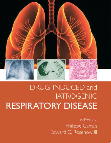 Drug-induced and Iatrogenic Respiratory Disease