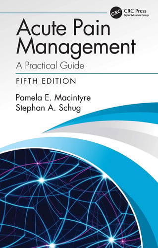 Acute pain management: a practical guide