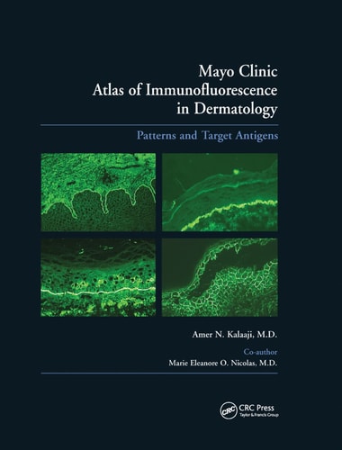Mayo Clinic Atlas of Immunofluorescence in Dermatology Patterns and Target Antigens