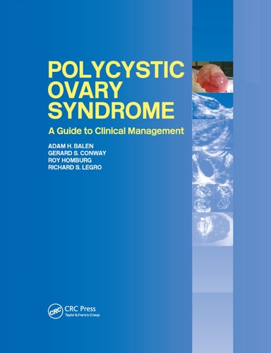 Polycystic Ovary Syndrome A Guide to Clinical Management